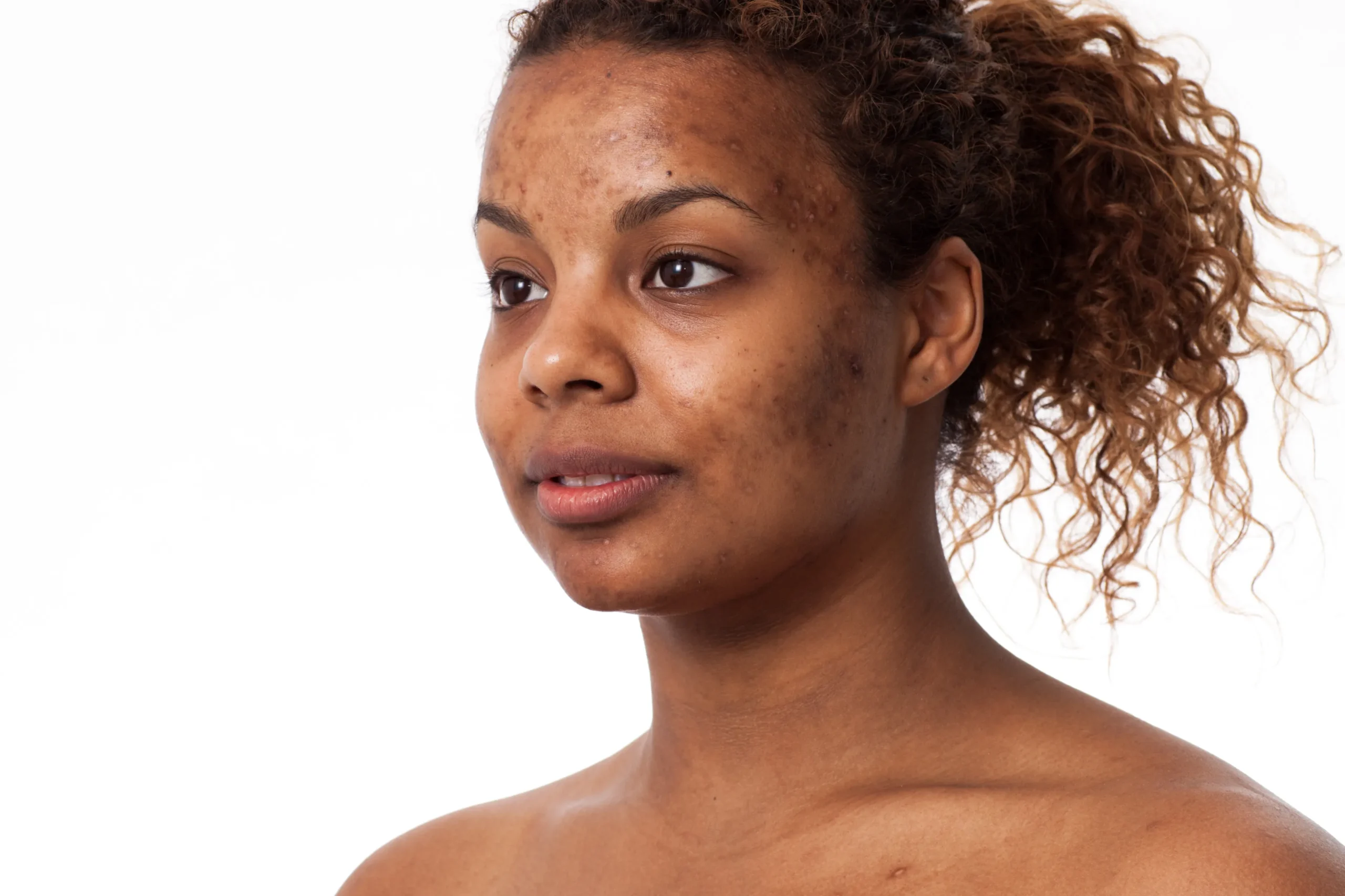 Jetzt COSRX kaufen und die besten Inhaltsstoffe der K-Beauty nutzen